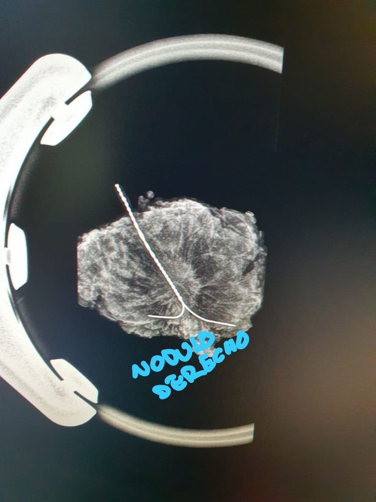 Ángel Millán Juárez-57