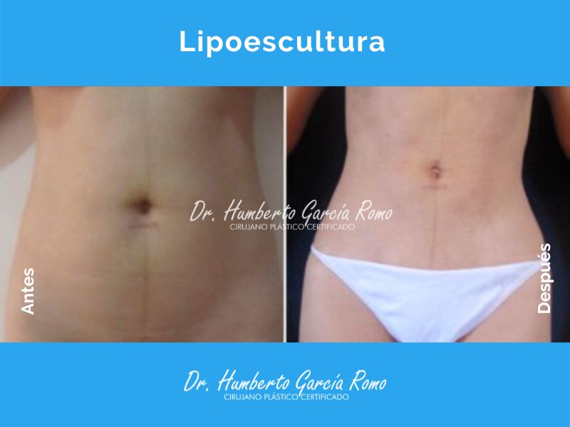 Humberto García Romo-2