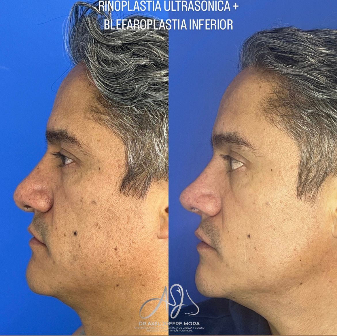 Axel Joffre Mora-5