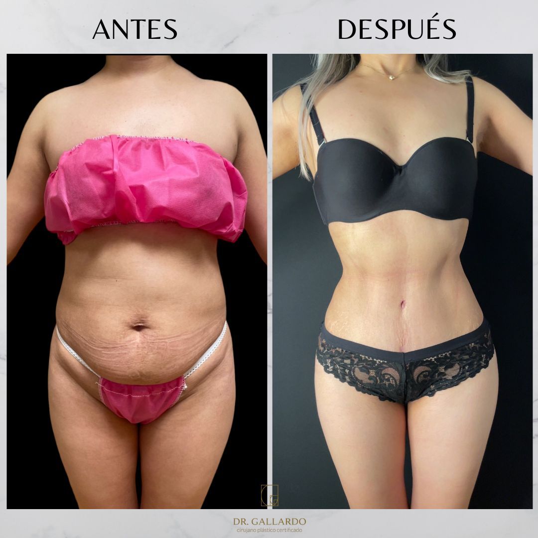 Fernando Gallardo-12