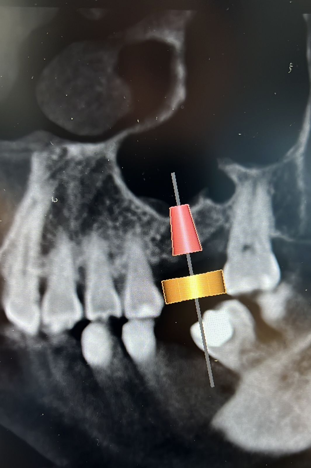 Jair Contreras García-33