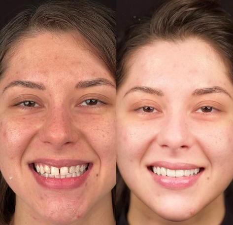 Juan Carlos Fernandez Illades-5