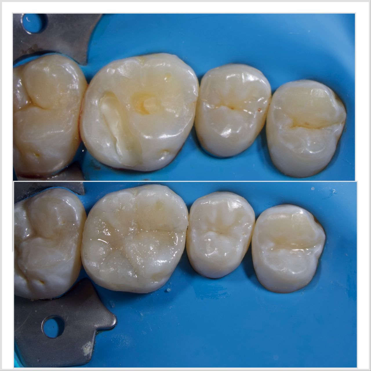 Hervin Eduardo Mendez Borrego-6