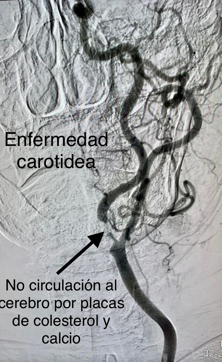 Miguel Abraham Lara Perez-10