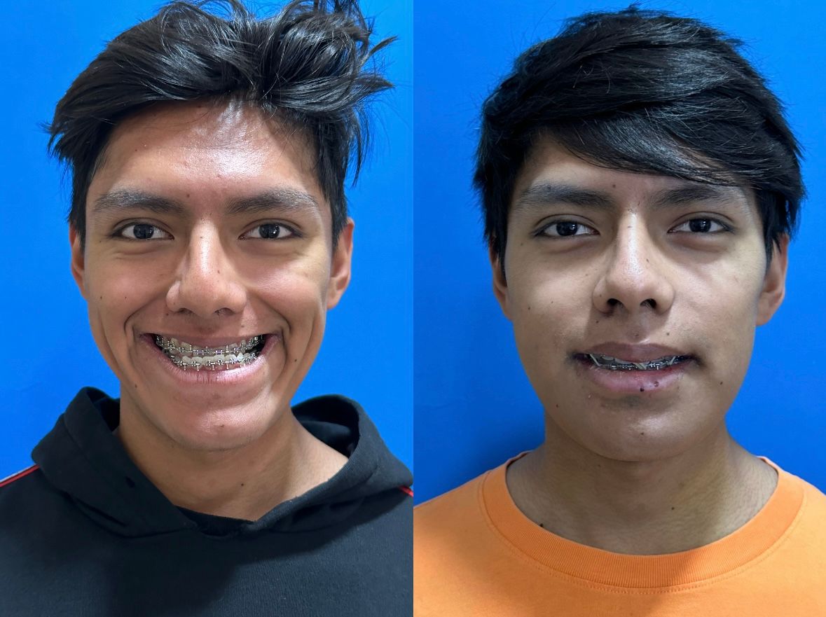 Nancy Valeria Lara Gayosso-4