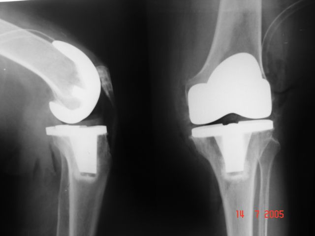 Ramon Garcia Acosta-11