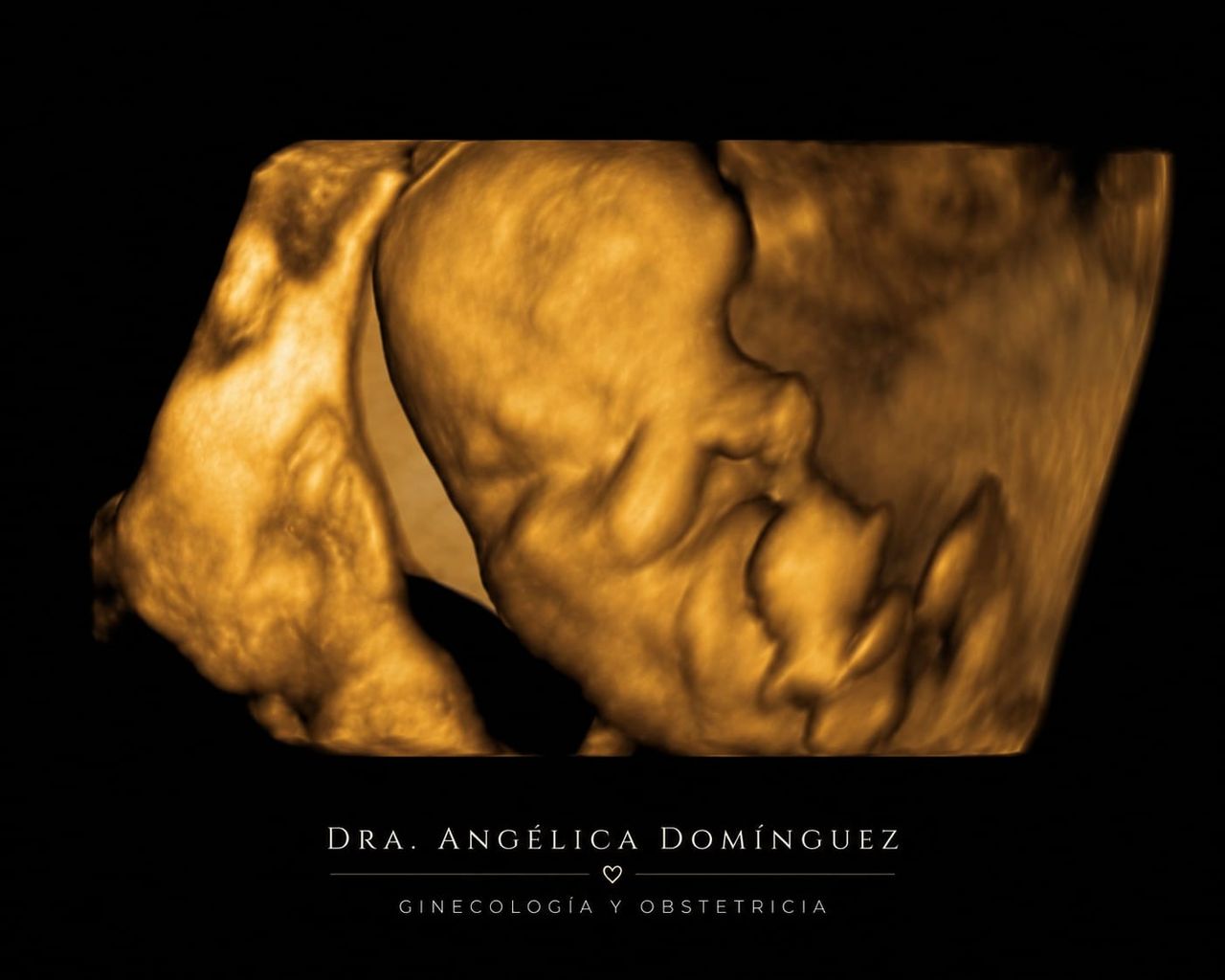 Angélica Amparo Dominguez Torres-3