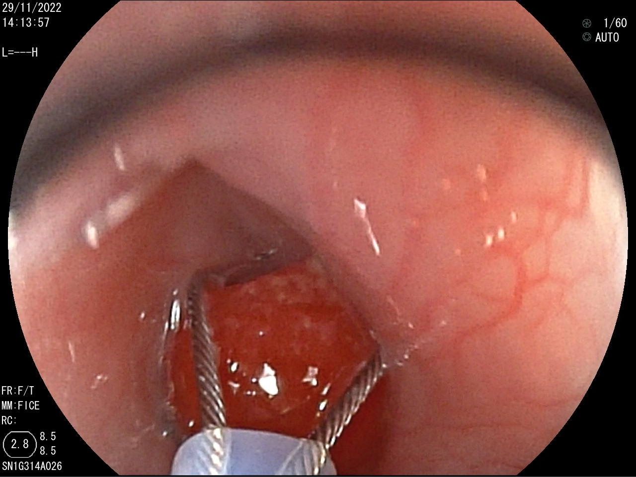 Byron Campoverde Arevalo-3