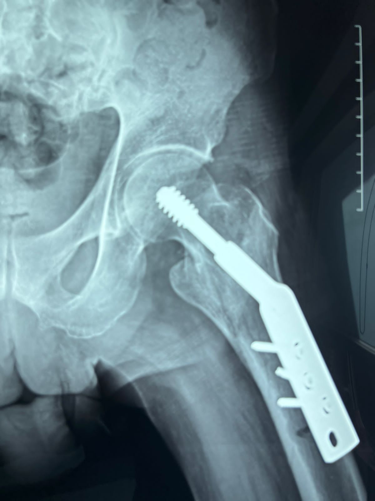 Oscar Alberto Pérez Peralta-21