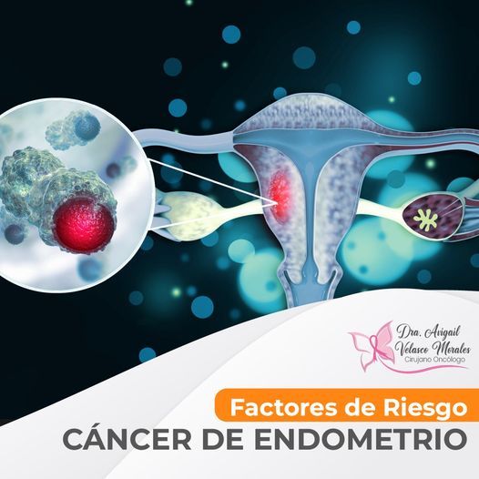 Avigail Soveida Velasco Morales-19