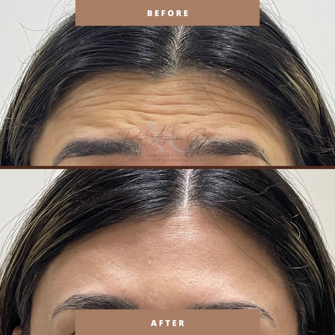 Alejandra Gutierrez García-20