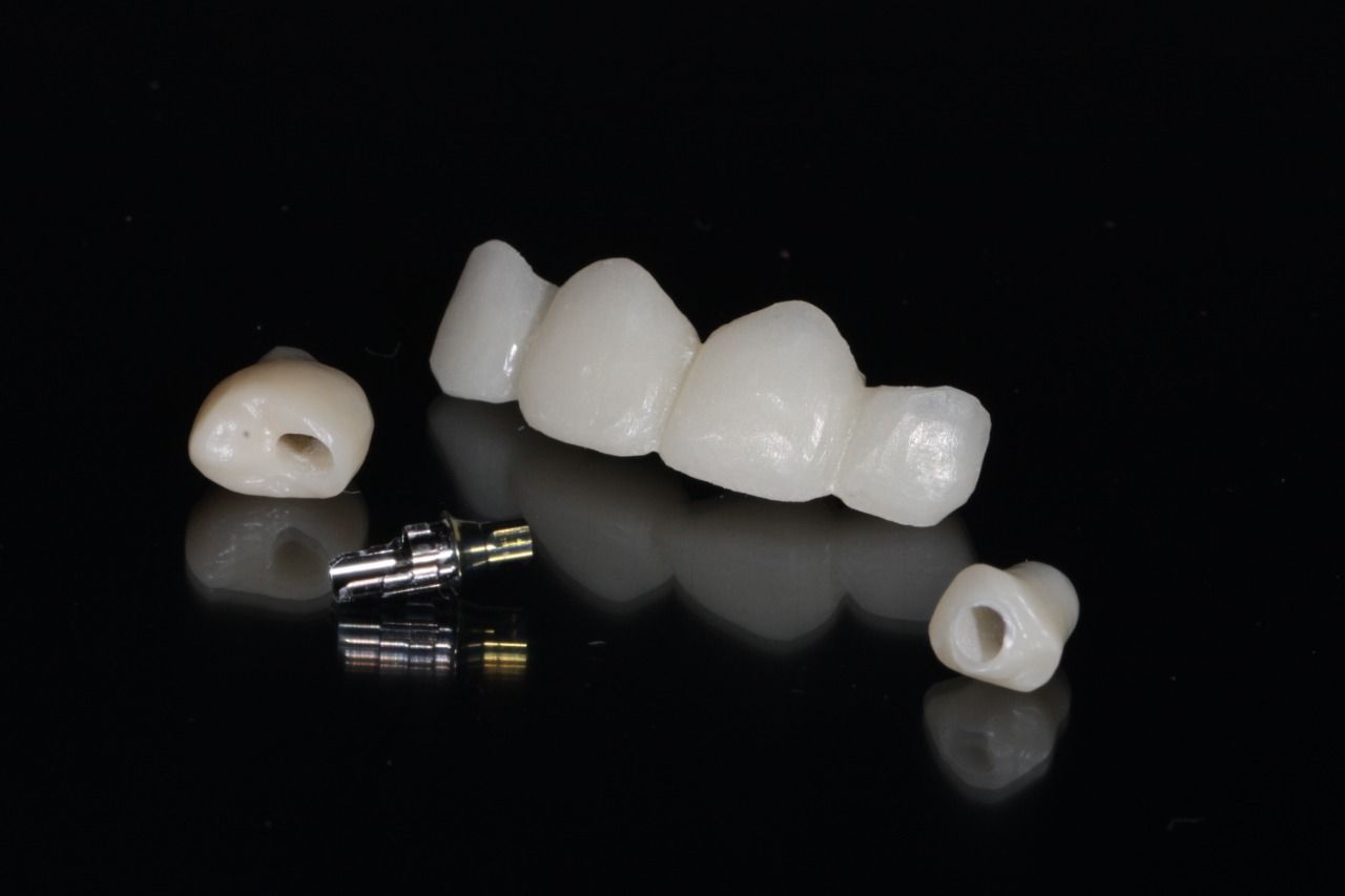 Luis Alonso Flores Reyna-12