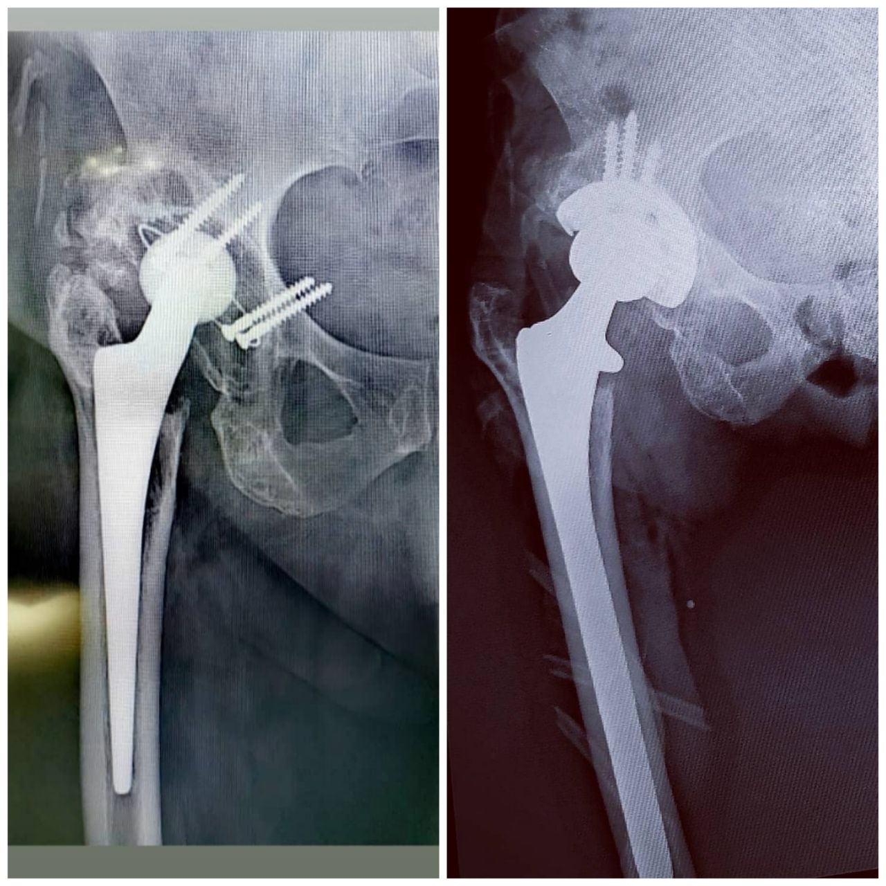 Avelino Colín Vázquez.-1