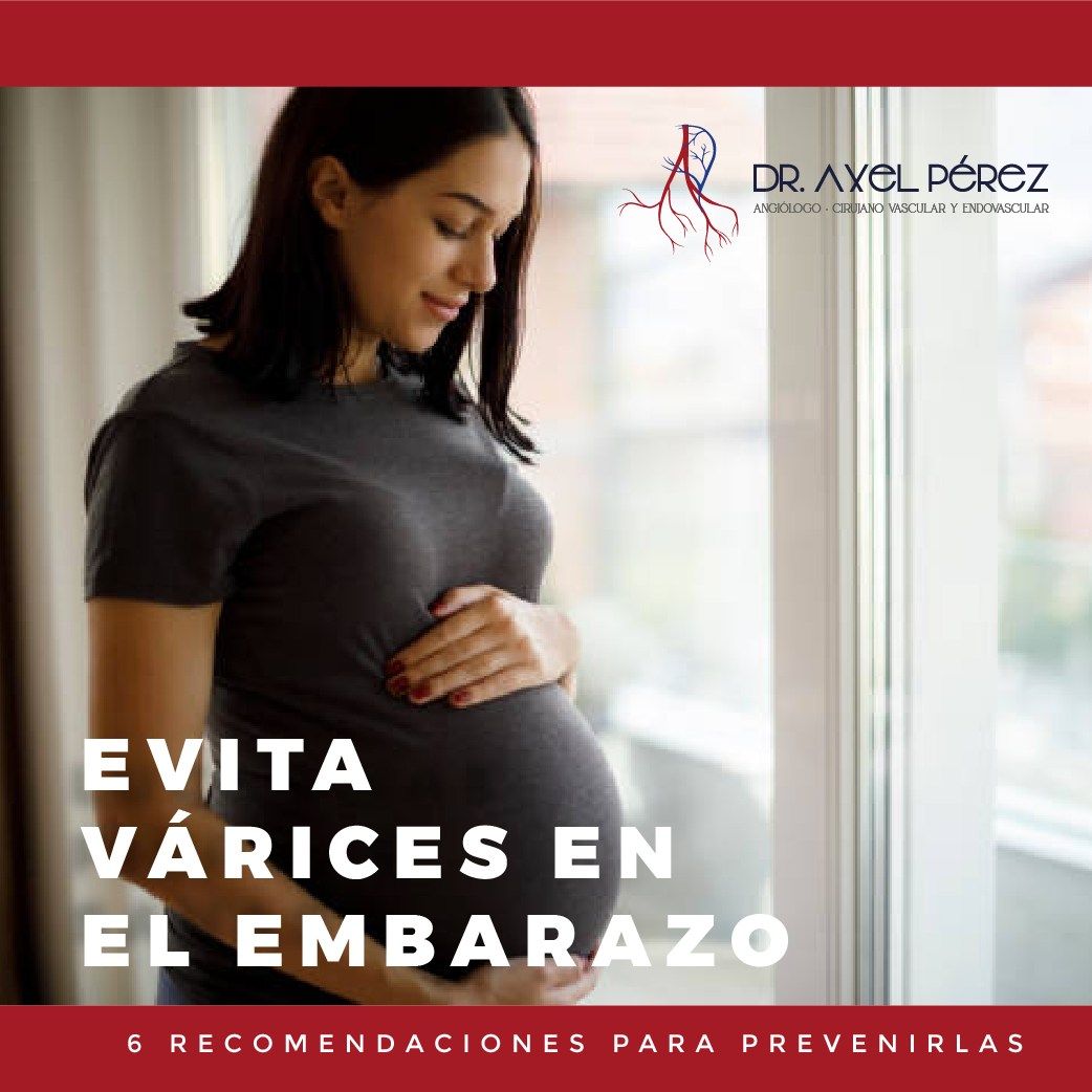 Axel Iván Pérez Flores-6
