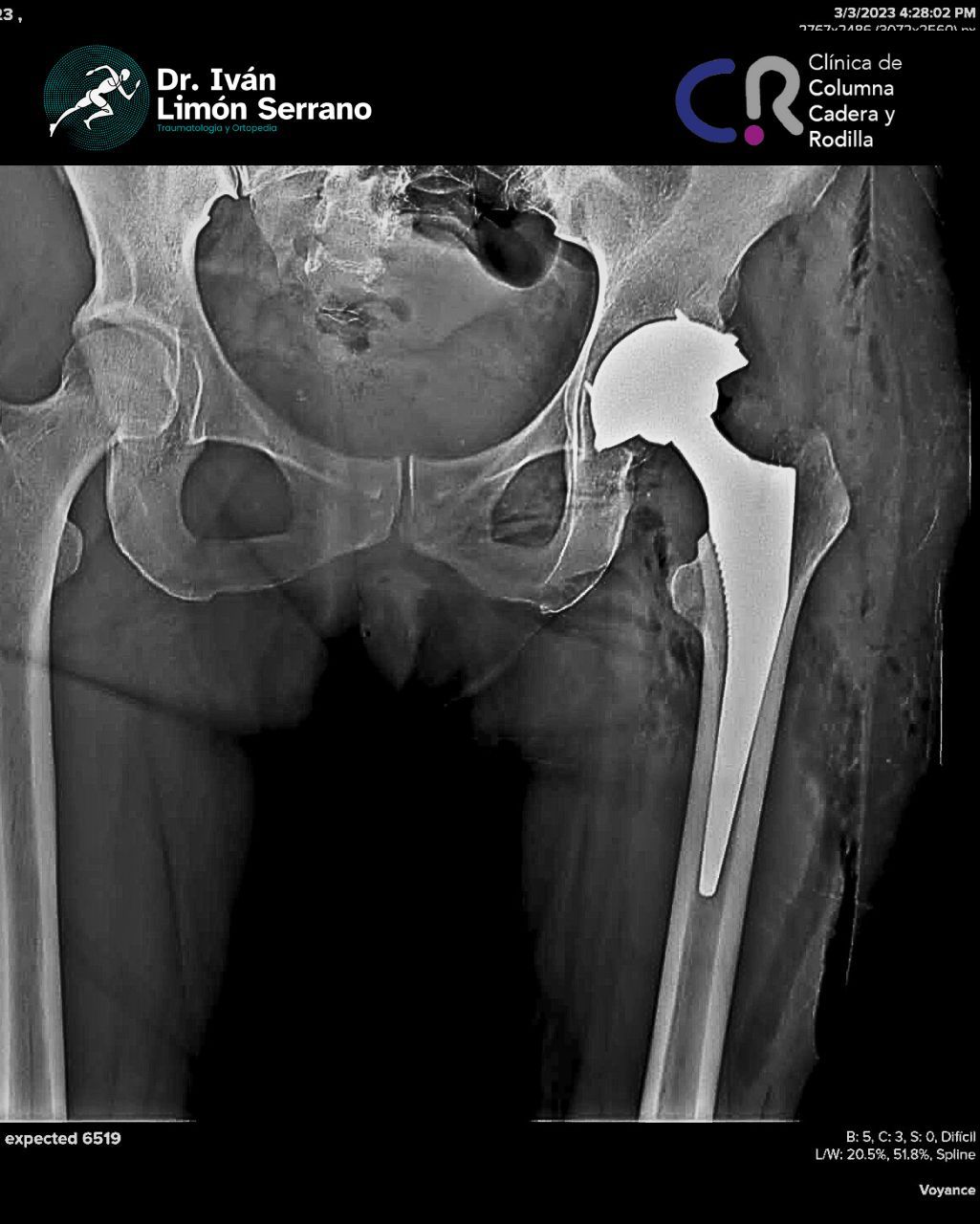 Iván Limón Serrano-33