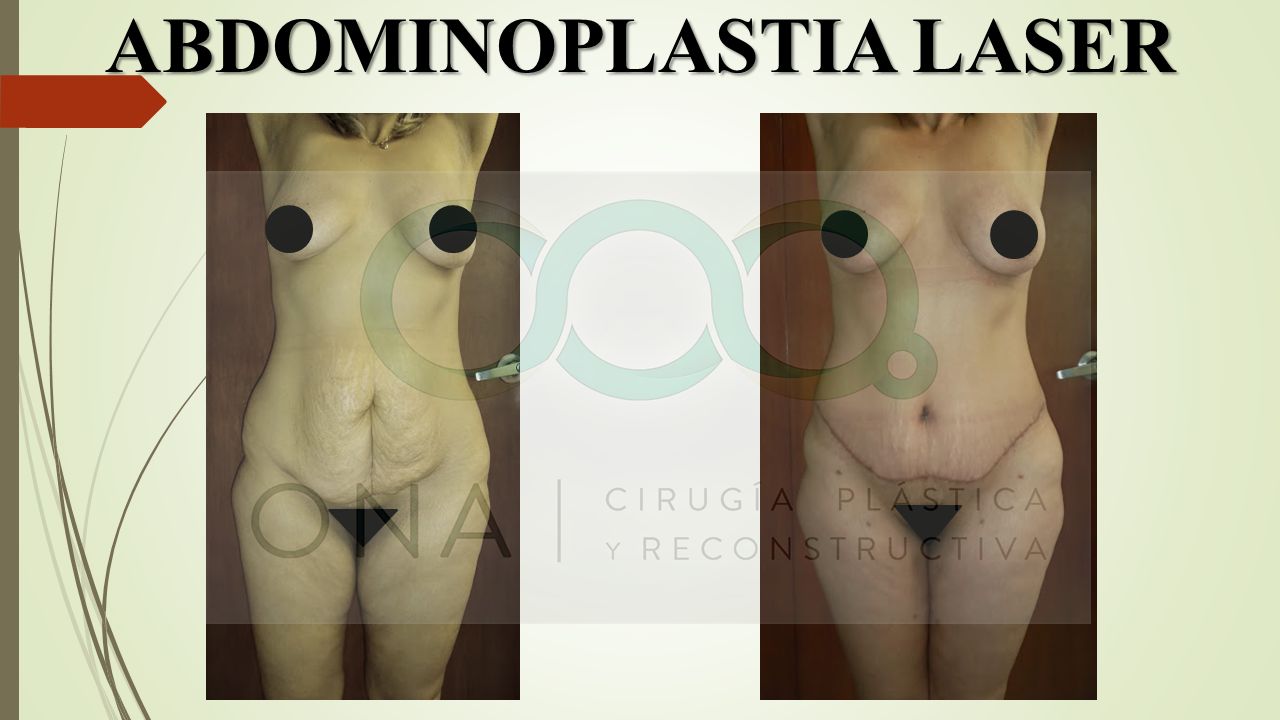 José Luis Segura Castillo-10