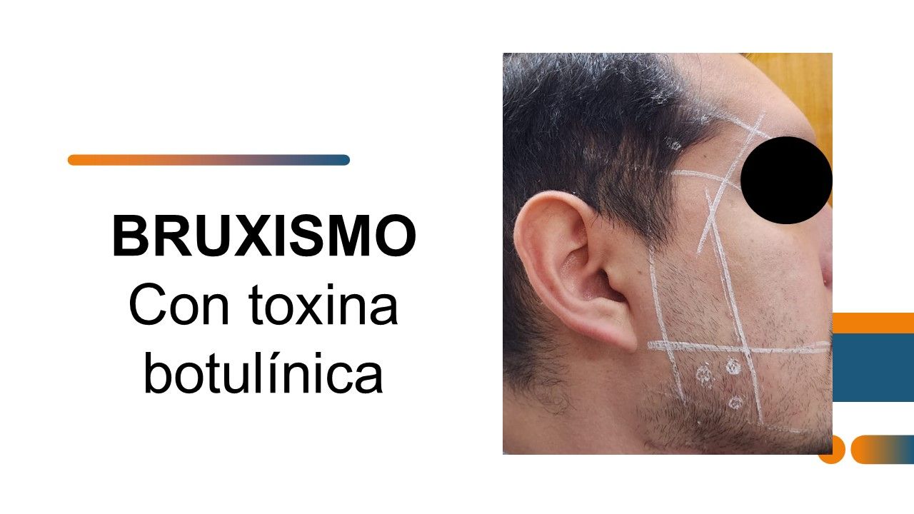 José Luis Muñoz Chapul-34