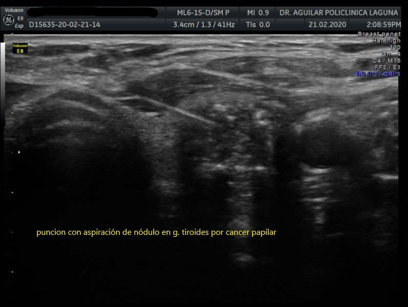 Edgar Fernando Aguilar Morales-6