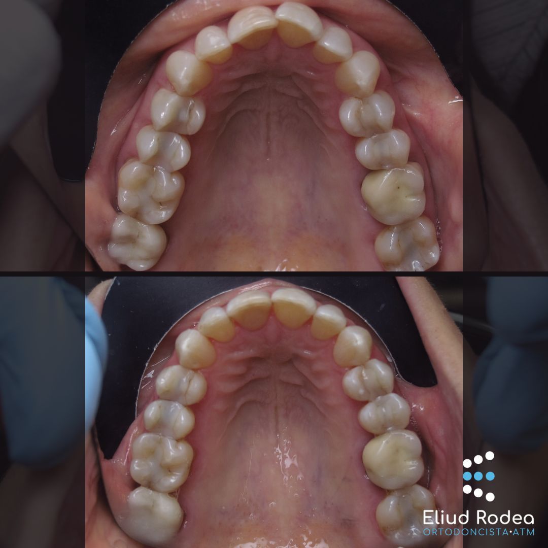 Eliud Rodea Monsivais-2