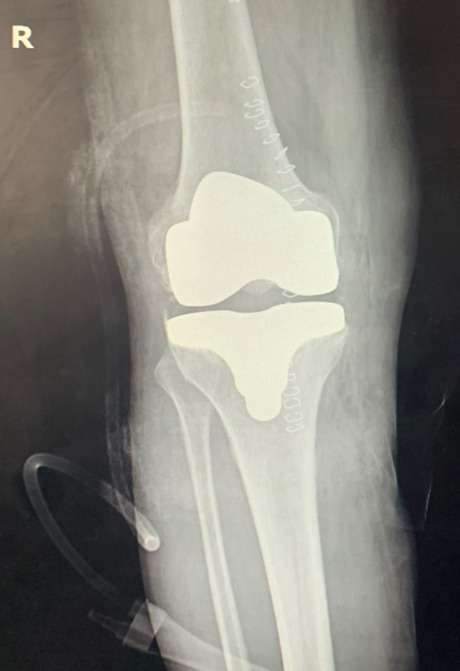 Jorge Antonio Acevedo Valdes-3