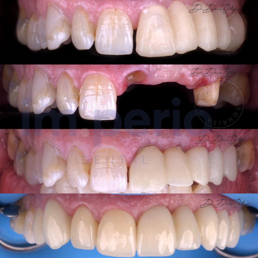 Dario Ortega Aceves-29