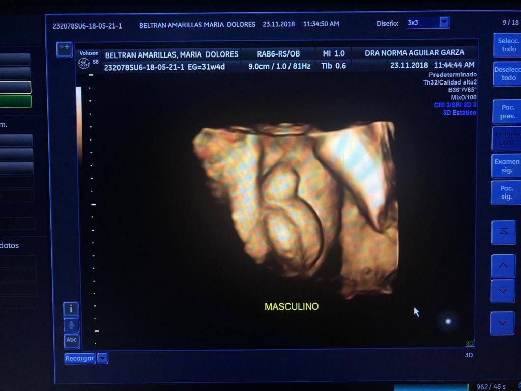 Norma Aguilar Garza-7