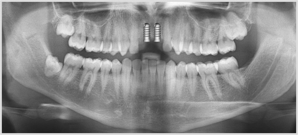 Juan Manuel Méndez Ferrusco-5