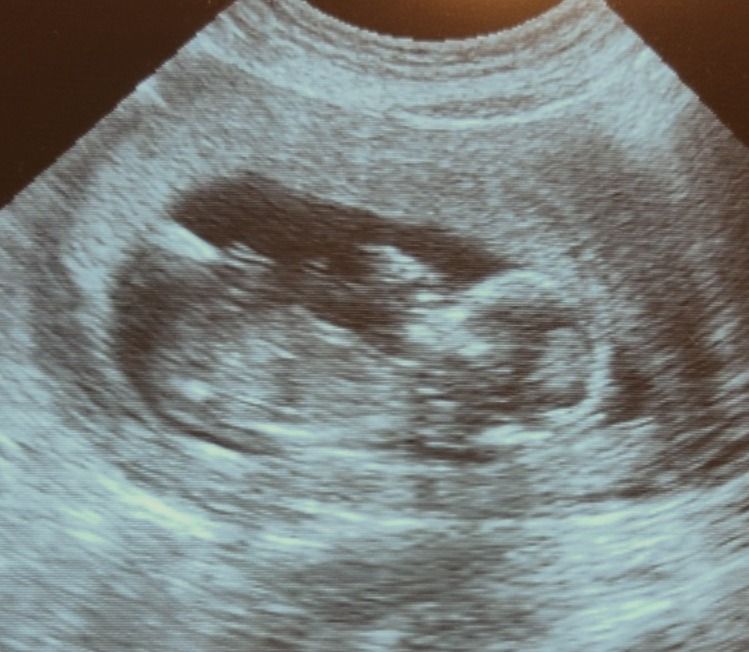 Jacqueline Matias Ricaño-1