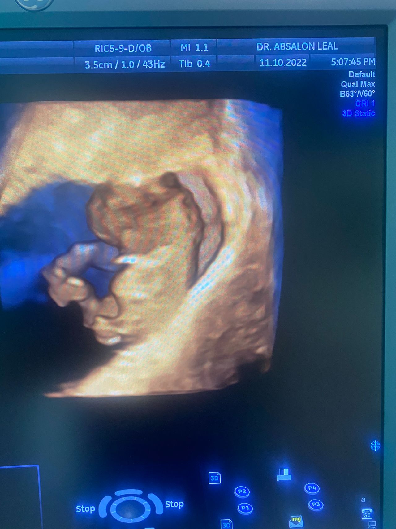 Absalon Leal Garza-5