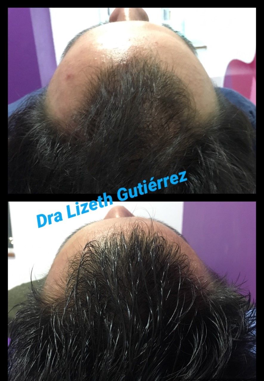 Lizeth Alejandra Gutiérrez Chavéz-18