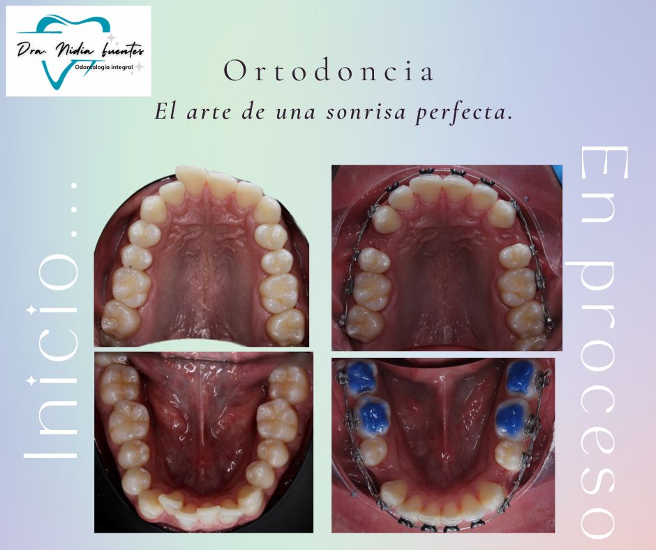 Nidia  Fuentes Aguilar-3