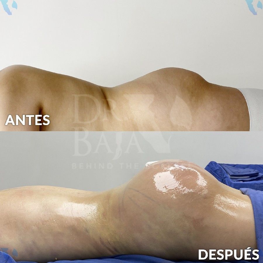 Renato Rodríguez Hirales-16