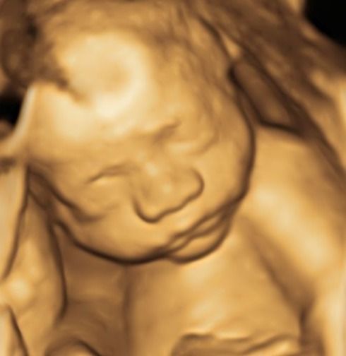 Dulce Anabel Jarquin Arango-53