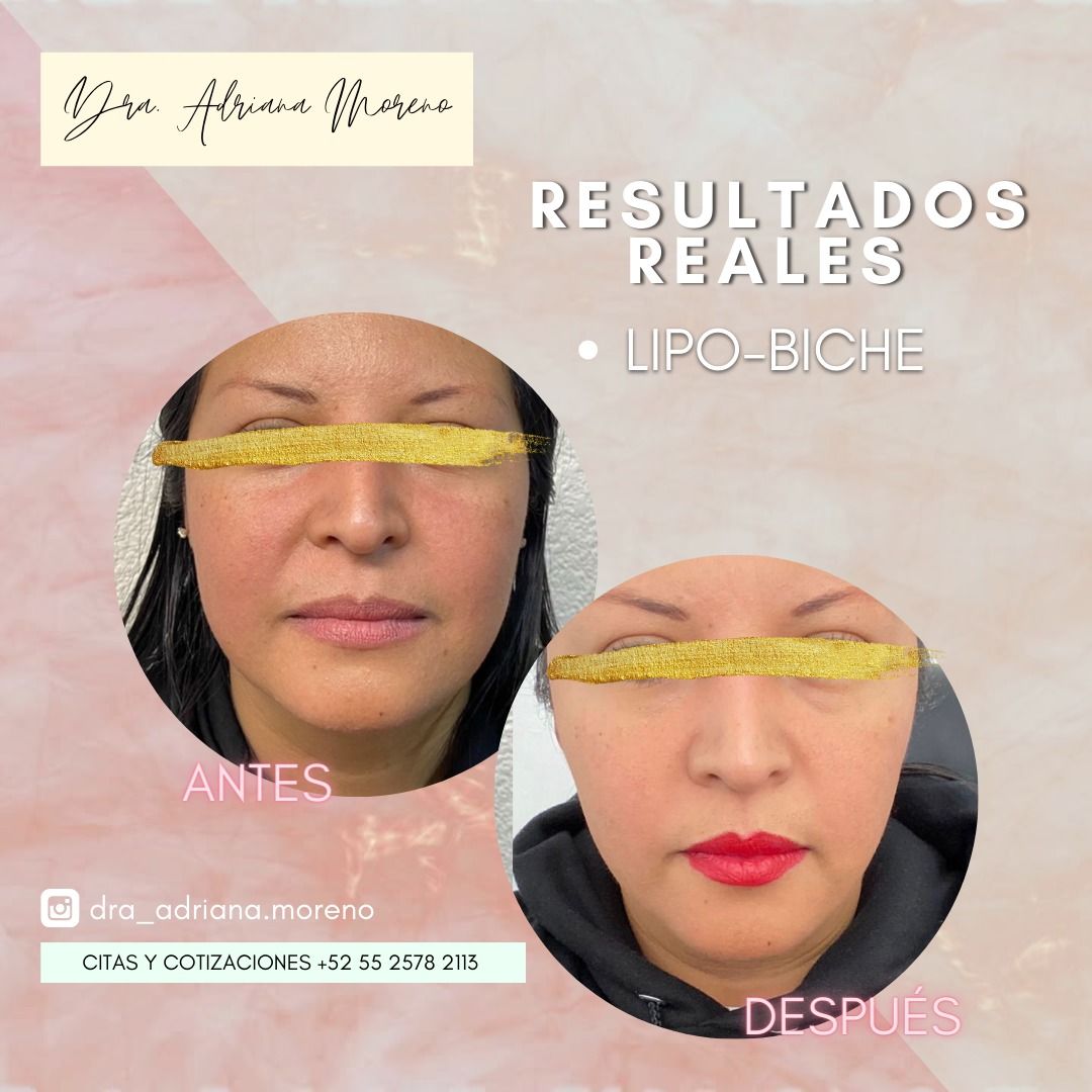 Adriana Moreno Jimenez-7