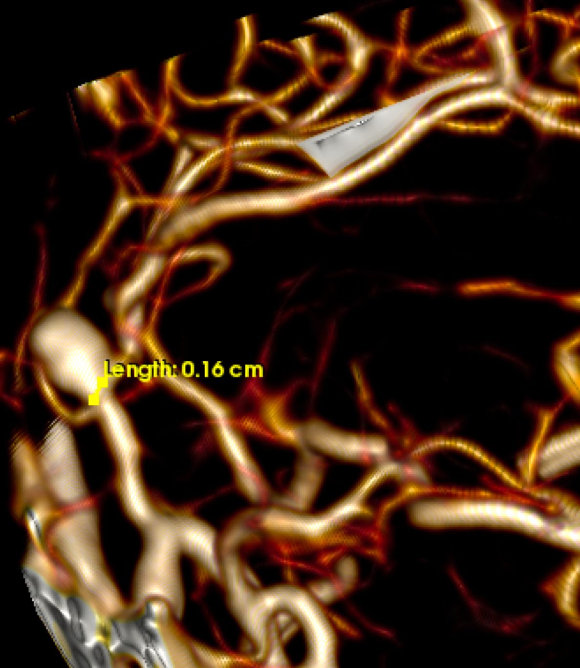 Alejandro Serrano Rubio-17