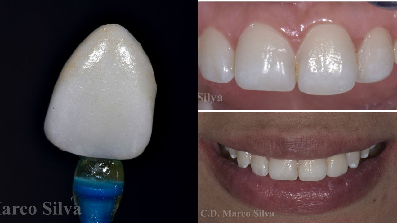 Marco Antonio Silva-4