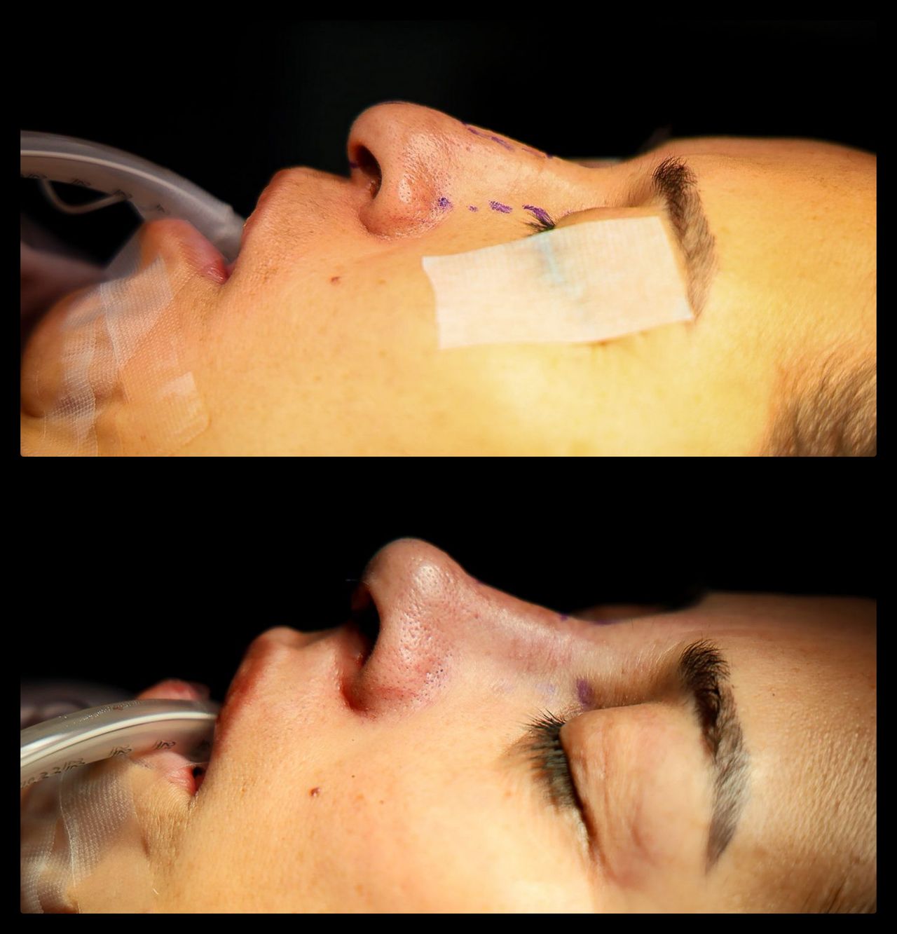 Alberto Hiracheta Torres-25