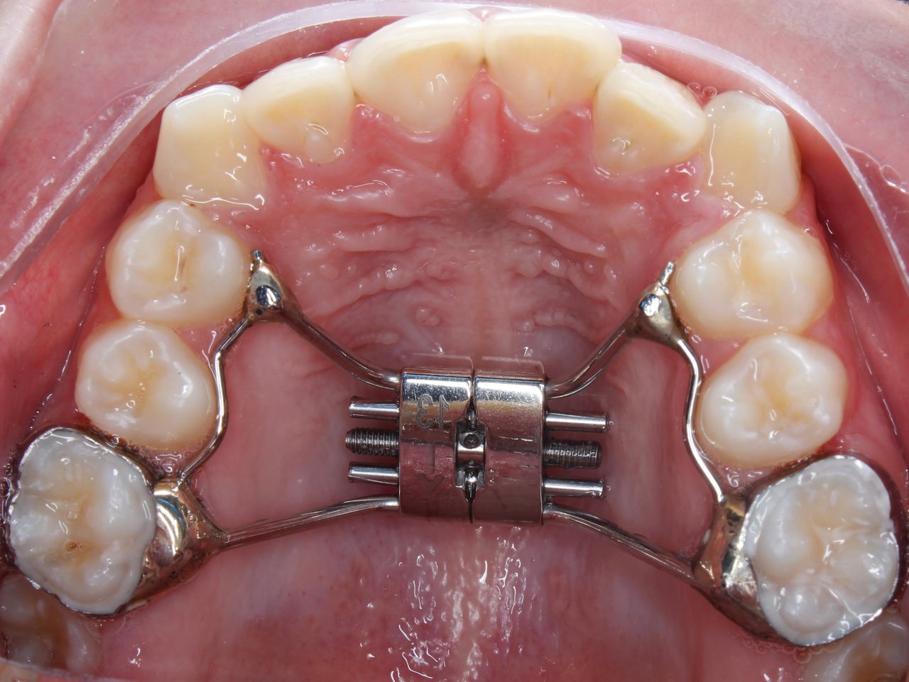 Fabián Delgado García-11