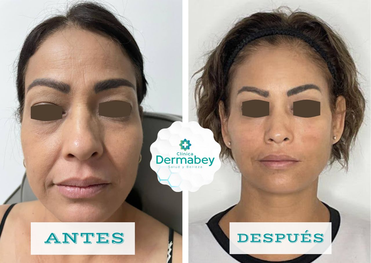 Fenicia Elena Martínez Bey-5