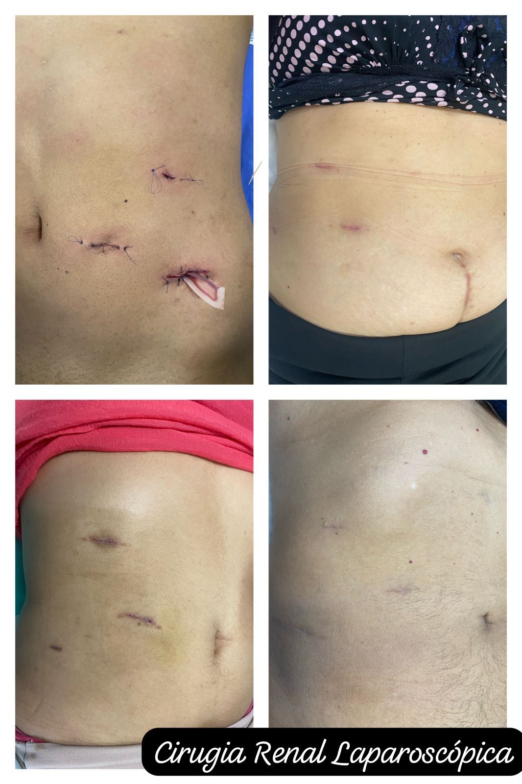 Ricardo Pérez Huerta-17