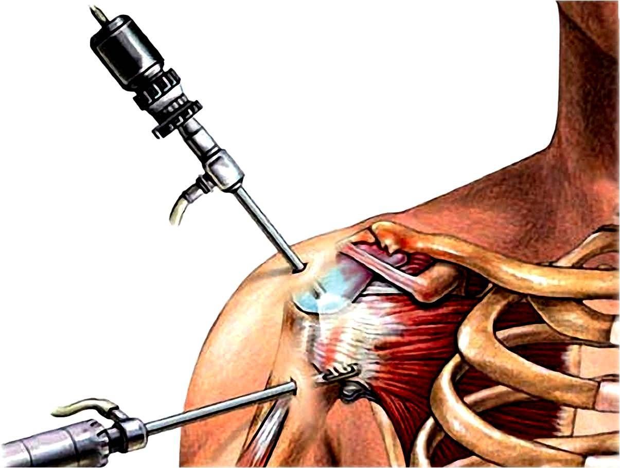 Antonio Velasco Leija-11