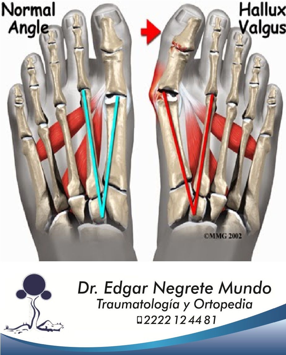 Edgar Negrete Mundo-5
