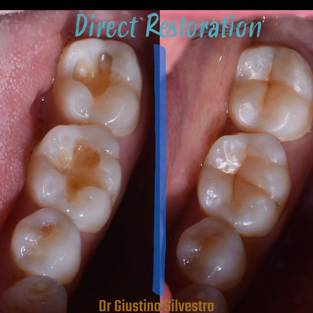 Giustino Silvestro-3