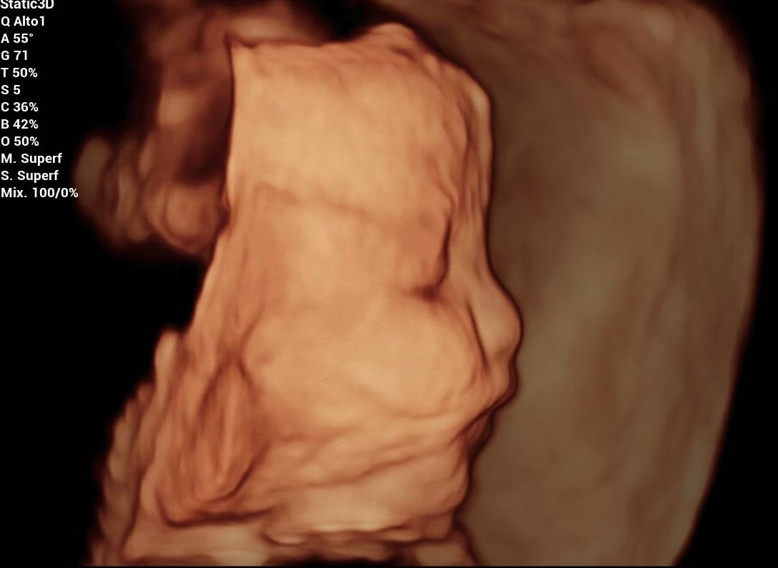 Karina Zepeda Vargas-1