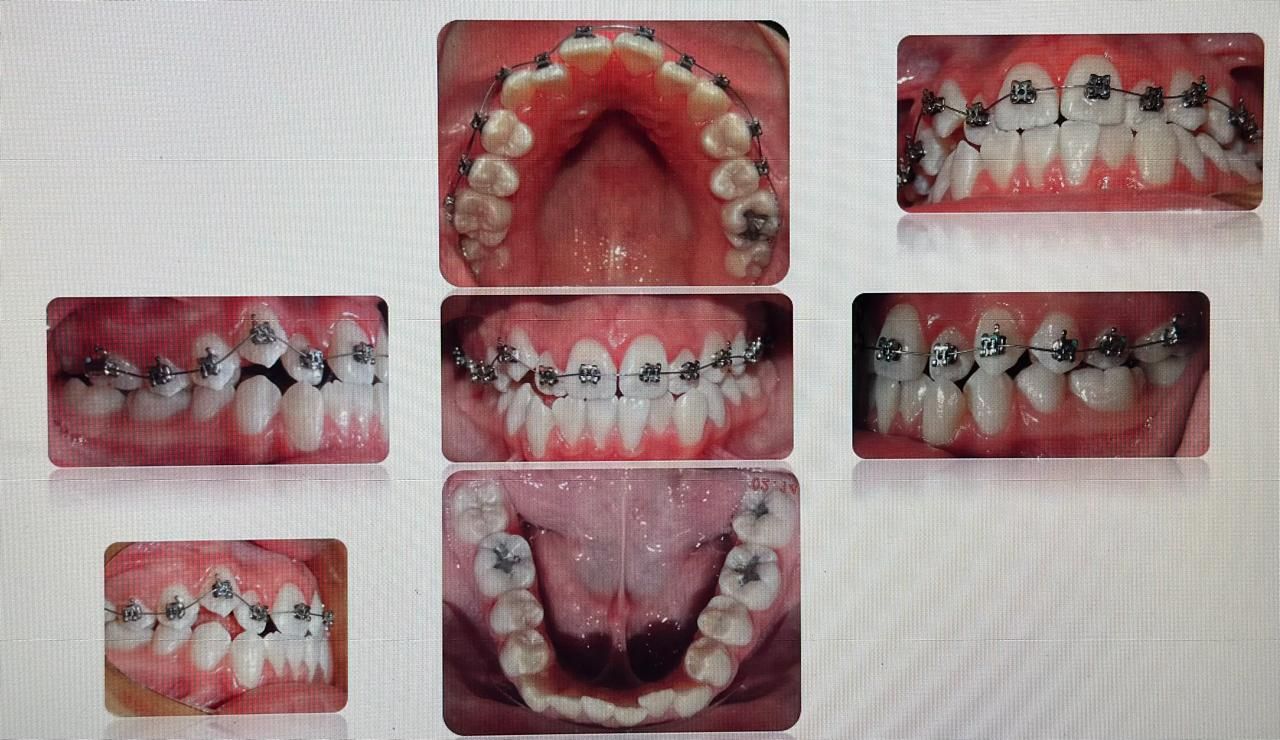 Antonio Gomez Arenas-10