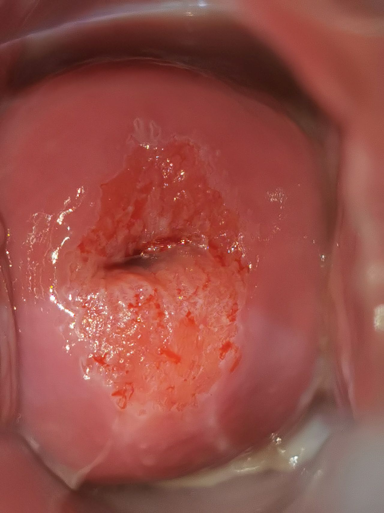 Marisol I. Alvarez Carrasco-32