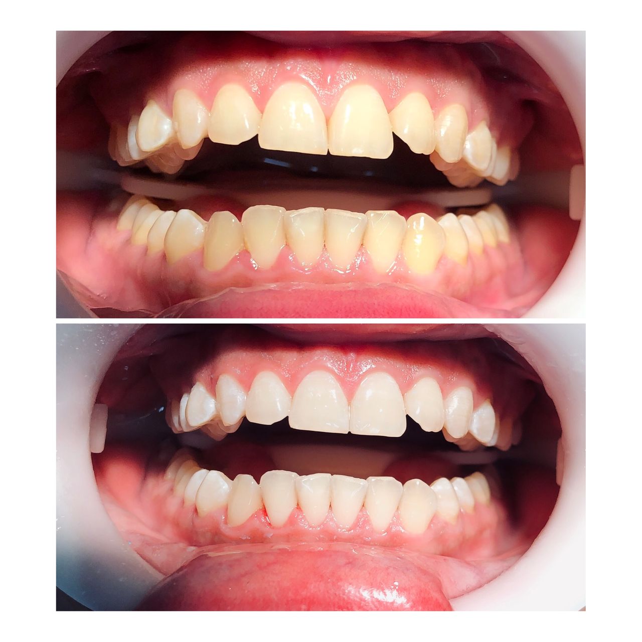 Zuriel Ayala Garcia-21