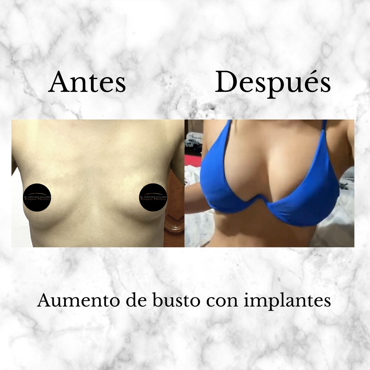 Fernando Gallardo-13