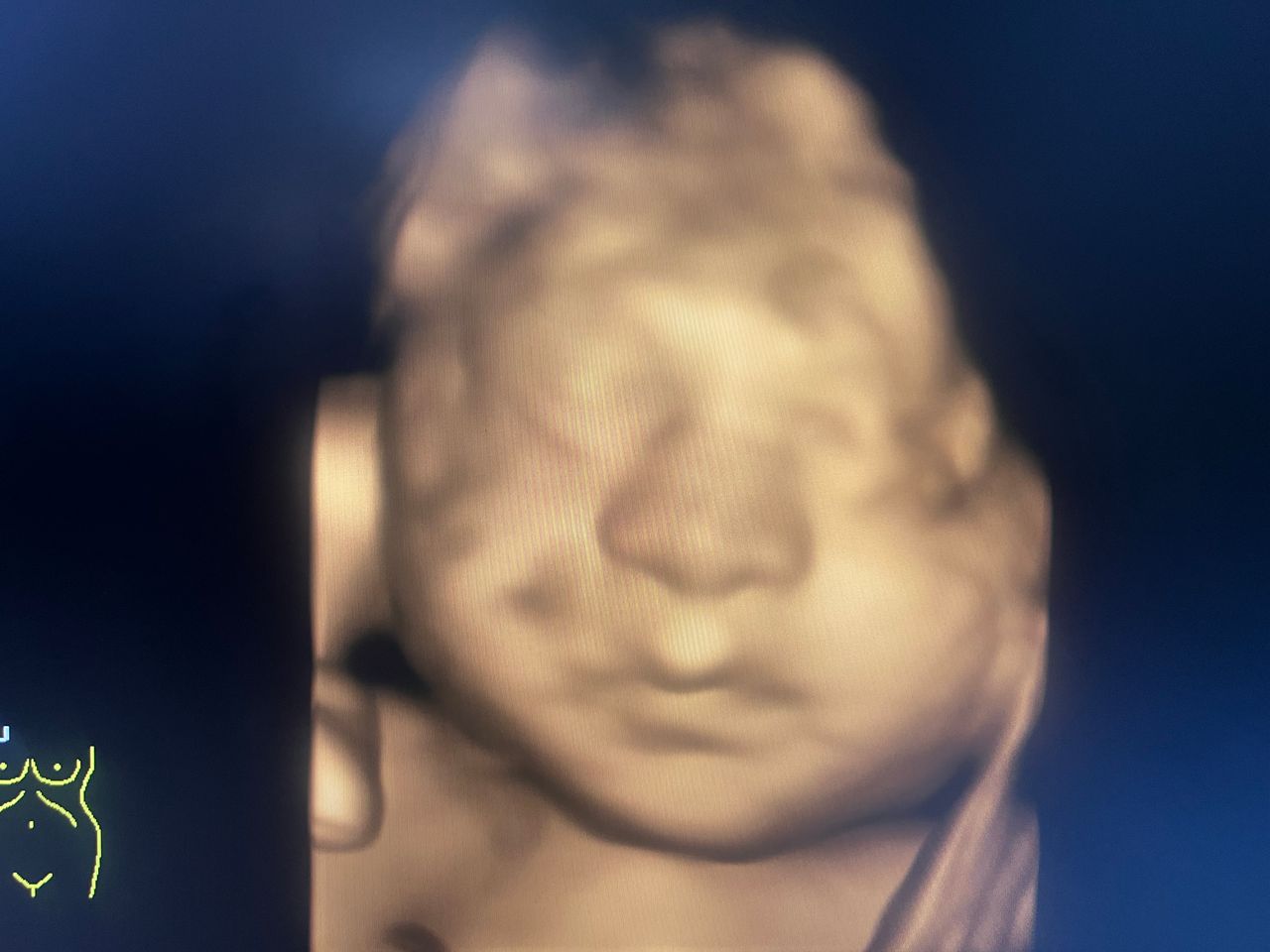 Jorge Artemio Almazán Chouza-5