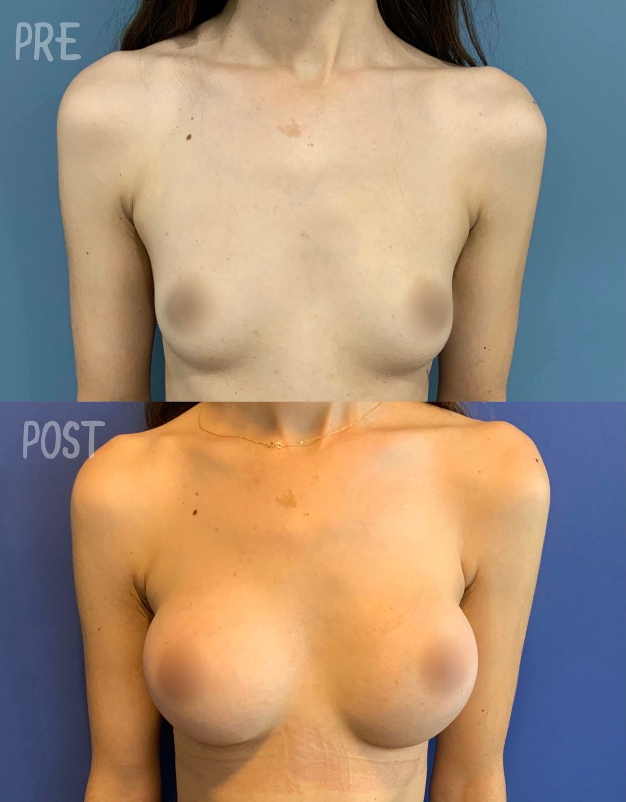 Giuseppe Tanzillo-48